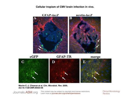 Cellular tropism of CMV brain infection in vivo.