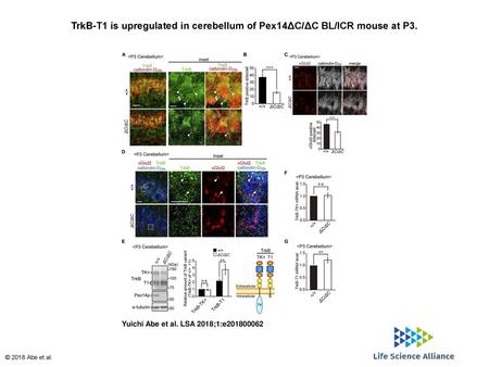 TrkB-T1 is upregulated in cerebellum of Pex14ΔC/ΔC BL/ICR mouse at P3.