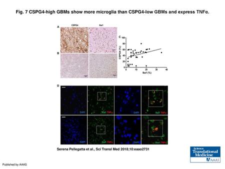 Fig. 7 CSPG4-high GBMs show more microglia than CSPG4-low GBMs and express TNFα. CSPG4-high GBMs show more microglia than CSPG4-low GBMs and express TNFα.