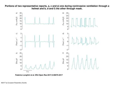 Portions of two representative reports, a, c and e) one during noninvasive ventilation through a helmet and b, d and f) the other through mask. Portions.