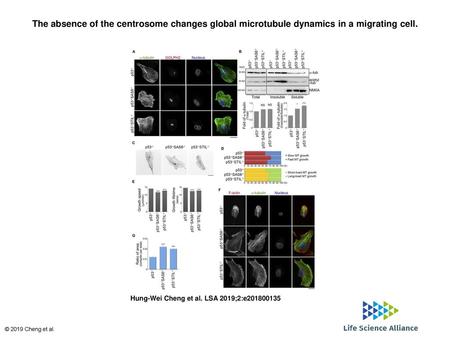 The absence of the centrosome changes global microtubule dynamics in a migrating cell. The absence of the centrosome changes global microtubule dynamics.