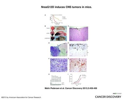 NrasG12D induces CNS tumors in mice.