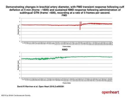 Demonstrating changes in brachial artery diameter, with FMD transient response following cuff deflation at 5 min (frame ∼1800) and sustained NMD response.