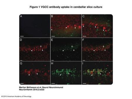 Figure 1 VGCC antibody uptake in cerebellar slice culture