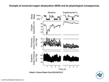 Example of nocturnal oxygen desaturation (NOD) and its physiological consequences. Example of nocturnal oxygen desaturation (NOD) and its physiological.