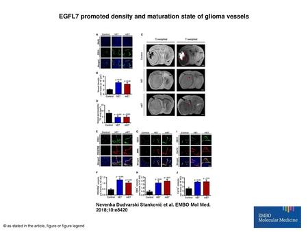 EGFL7 promoted density and maturation state of glioma vessels