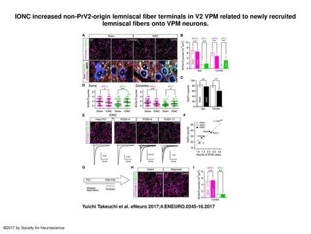 IONC increased non-PrV2-origin lemniscal fiber terminals in V2 VPM related to newly recruited lemniscal fibers onto VPM neurons. IONC increased non-PrV2-origin.