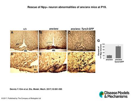 Rescue of Npy+ neuron abnormalities of anx/anx mice at P19.