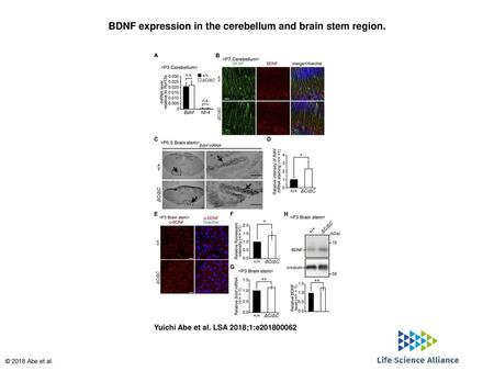 BDNF expression in the cerebellum and brain stem region.