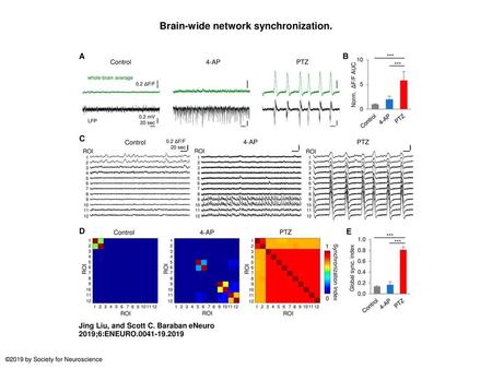 Brain-wide network synchronization.