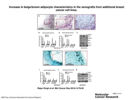 Increase in beige/brown adipocyte characteristics in the xenografts from additional breast cancer cell lines. Increase in beige/brown adipocyte characteristics.