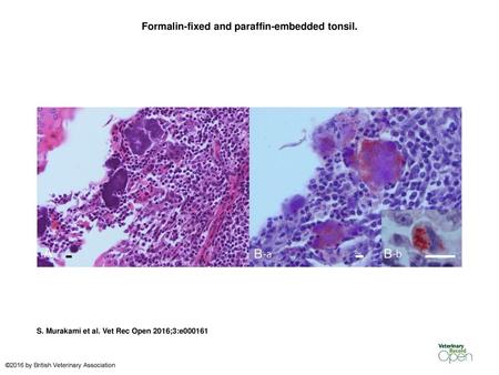 Formalin-fixed and paraffin-embedded tonsil.