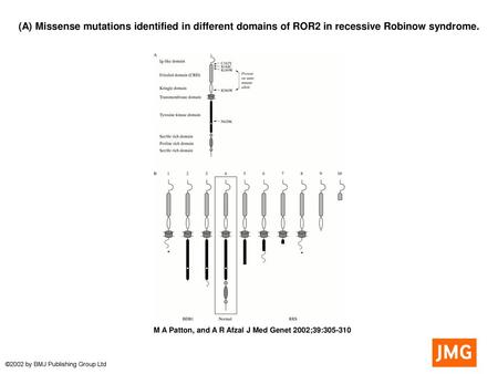 (A) Missense mutations identified in different domains of ROR2 in recessive Robinow syndrome. (A) Missense mutations identified in different domains of.