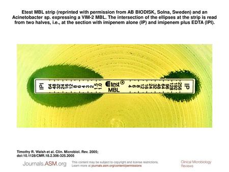 Etest MBL strip (reprinted with permission from AB BIODISK, Solna, Sweden) and an Acinetobacter sp. expressing a VIM-2 MBL. The intersection of the ellipses.