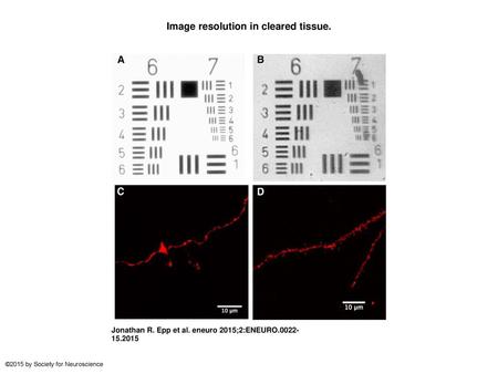 Image resolution in cleared tissue.