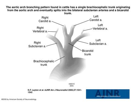 The aortic arch branching pattern found in cattle has a single brachiocephalic trunk originating from the aortic arch and eventually splits into the bilateral.
