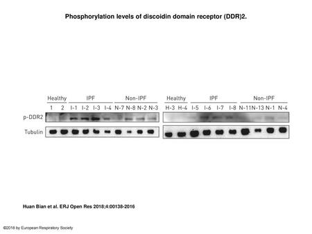 Phosphorylation levels of discoidin domain receptor (DDR)2.