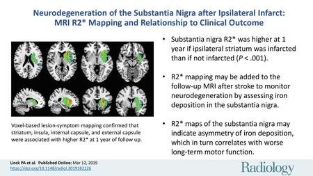 Neurodegeneration of the Substantia Nigra after Ipsilateral Infarct: MRI R2* Mapping and Relationship to Clinical Outcome Substantia nigra R2* was higher.