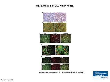 Fig. 2 Analysis of CLL lymph nodes.