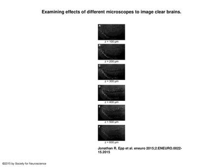 Examining effects of different microscopes to image clear brains.