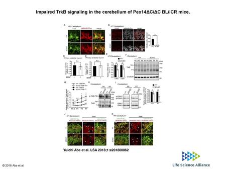 Impaired TrkB signaling in the cerebellum of Pex14ΔC/ΔC BL/ICR mice.