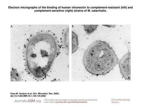 Electron micrographs of the binding of human vitronectin to complement-resistant (left) and complement-sensitive (right) strains of M. catarrhalis. Electron.