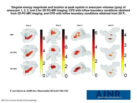 Singular-energy magnitude and location at peak systole in aneurysm volumes (gray) of aneurysm 1, 2, 3, and 5 for 3D PC-MR imaging; CFD with inflow boundary.