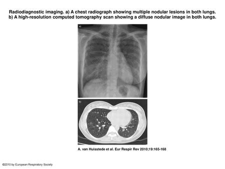 Radiodiagnostic imaging