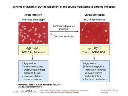 Scheme of dynamic SCV development in the course from acute to chronic infection. Scheme of dynamic SCV development in the course from acute to chronic.