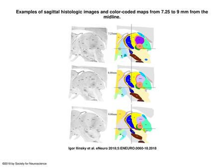 Examples of sagittal histologic images and color-coded maps from 7