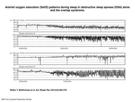 Arterial oxygen saturation (SaO2) patterns during sleep in obstructive sleep apnoea (OSA) alone and the overlap syndrome. Arterial oxygen saturation (SaO2)