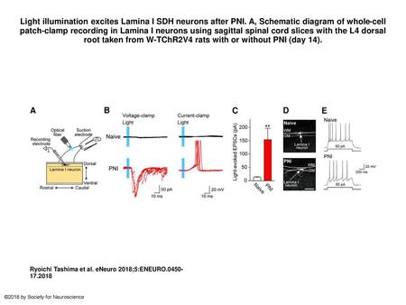 Light illumination excites Lamina I SDH neurons after PNI