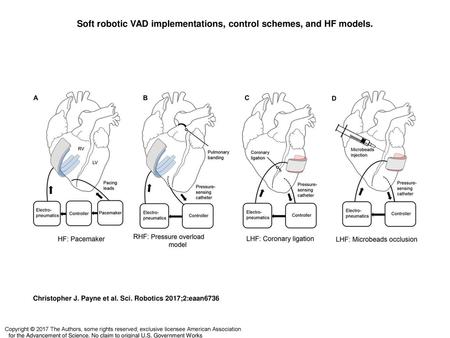 Soft robotic VAD implementations, control schemes, and HF models.