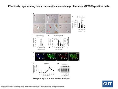 Effectively regenerating livers transiently accumulate proliferative IGF2BP3-positive cells. Effectively regenerating livers transiently accumulate proliferative.