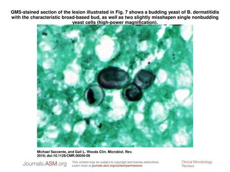 GMS-stained section of the lesion illustrated in Fig