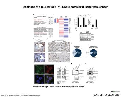 Existence of a nuclear NFATc1–STAT3 complex in pancreatic cancer.