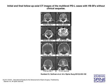Initial and final follow-up axial CT images of the multilevel PD-L cases with VB-SFs without clinical sequelae. Initial and final follow-up axial CT images.