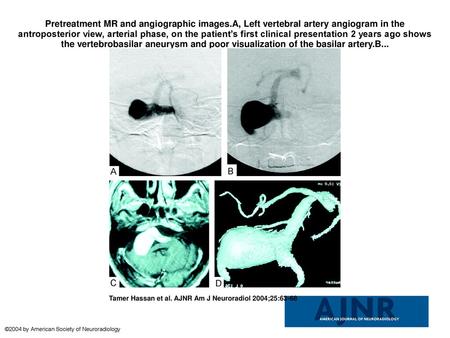 Pretreatment MR and angiographic images