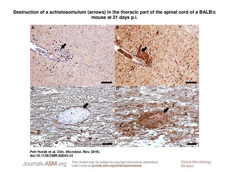 Destruction of a schistosomulum (arrows) in the thoracic part of the spinal cord of a BALB/c mouse at 21 days p.i. Destruction of a schistosomulum (arrows)
