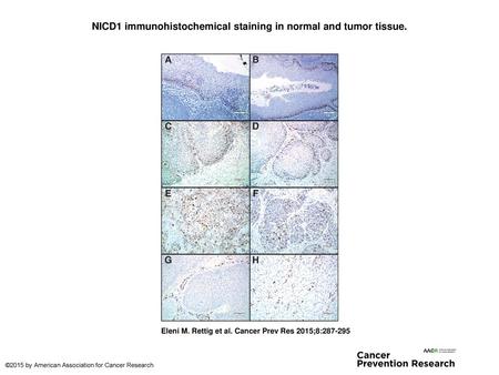 NICD1 immunohistochemical staining in normal and tumor tissue.