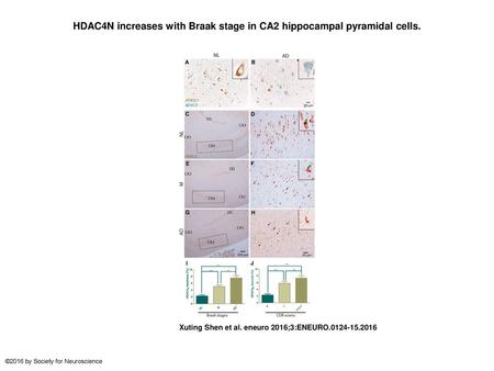 HDAC4N increases with Braak stage in CA2 hippocampal pyramidal cells.