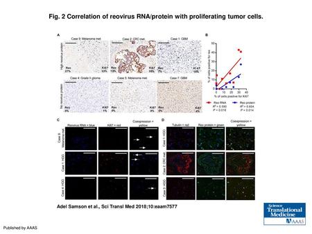 Correlation of reovirus RNA/protein with proliferating tumor cells