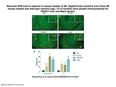 Neuronal ATM level is reduced in mouse models of AD