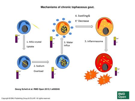 Mechanisms of chronic tophaceous gout.