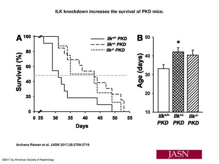 ILK knockdown increases the survival of PKD mice.