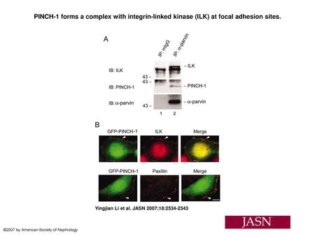 PINCH-1 forms a complex with integrin-linked kinase (ILK) at focal adhesion sites. PINCH-1 forms a complex with integrin-linked kinase (ILK) at focal adhesion.
