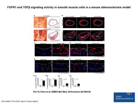 FGFR1 and TGFβ signaling activity in smooth muscle cells in a mouse atherosclerosis model FGFR1 and TGFβ signaling activity in smooth muscle cells in a.