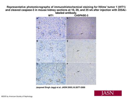 Representative photomicrographs of immunohistochemical staining for Wilms’ tumor 1 (WT1) and cleaved caspase-3 in mouse kidney sections at 10, 20, and.