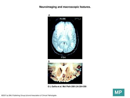 Neuroimaging and macroscopic features.