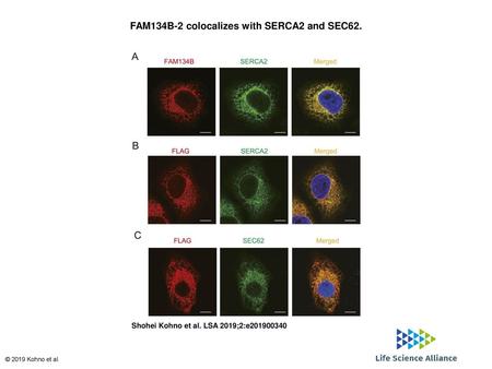 FAM134B-2 colocalizes with SERCA2 and SEC62.